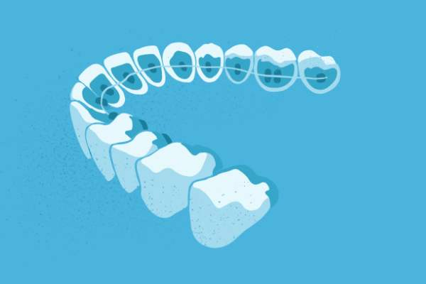 惟德口腔醫院口腔正畸好不好？